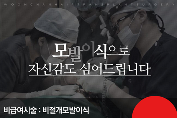 움찬모발이식